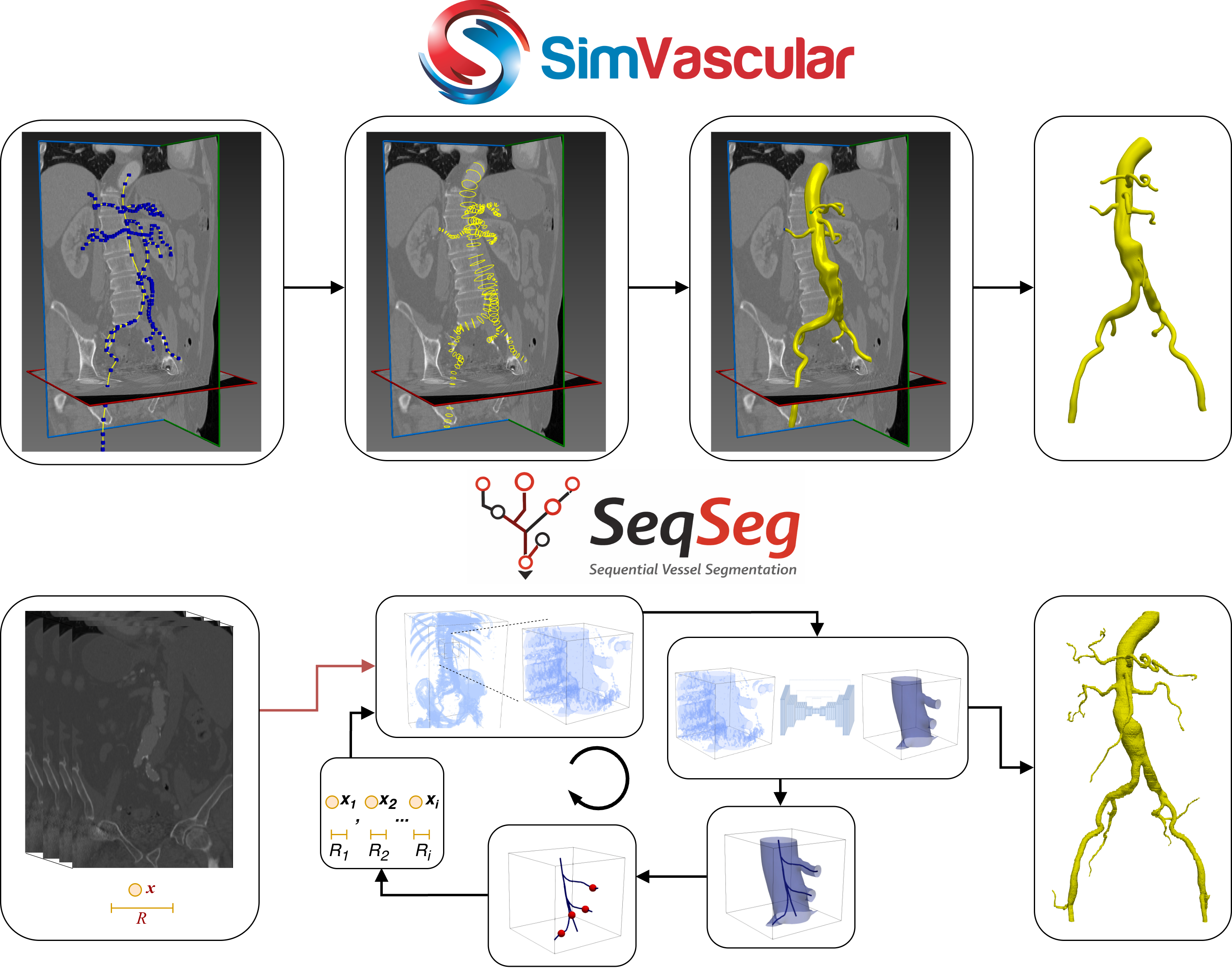 Comparison of the manual SimVascular modeling workflow (top) against the automated SeqSeg workflow (bottom)